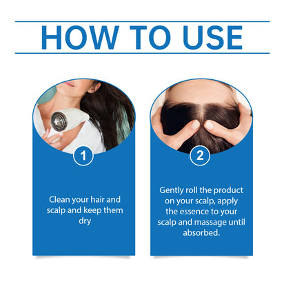 25mlHair Care Serum Roll-On Prevent Hair Loss Baldness Scalp Massage Repair Dry Damaged Hair 3% Rosemary Nourishing Hair Essence